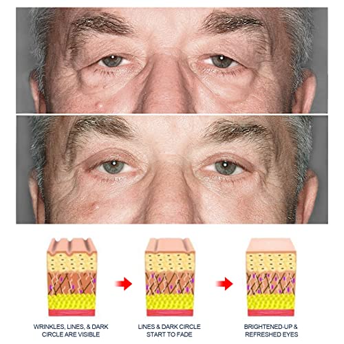 East Moon Men's Cool Tender Eye Cream: Hydrating, Reduces Dark Circles & Puffiness